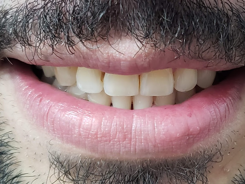 Foto 2 de Dentista - Dr. Cassio Alves Carvalho Tsai