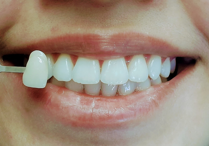 Foto 3 de Dentista Dr. Claudio Colombo