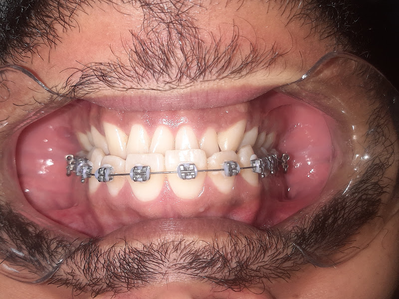 Foto 3 de Dentista Dr. Erme Antas Florentino Junior