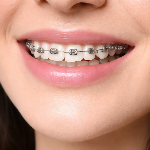 Foto 3 de Dentista Dr Fausto Queiroz I Implante Dentário em Salvador