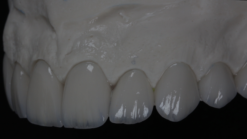 Foto 2 de Dentista - Dr.Fernando Andrade Odontologia Estética&Funcional