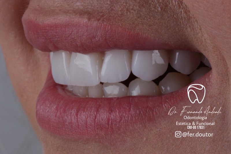 Foto 3 de Dentista - Dr.Fernando Andrade Odontologia Estética&Funcional