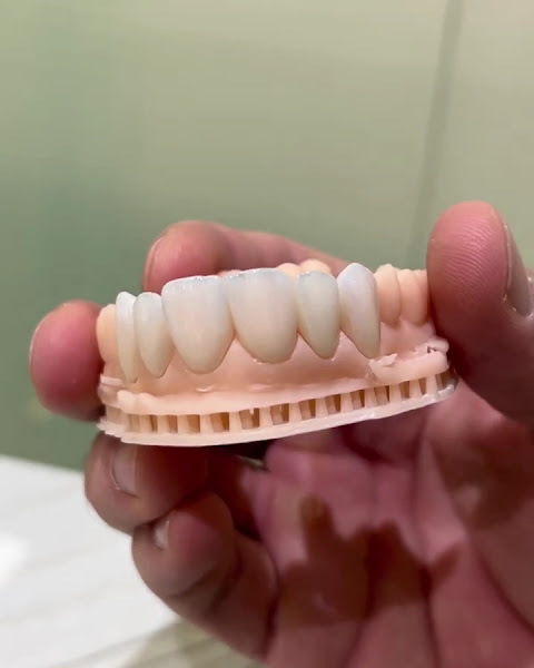 Foto 4 de Dentista Dr. Fernando Brasil | Odontologia de Alto Impacto| Lentes de Contato Dental | Implantes Dentários