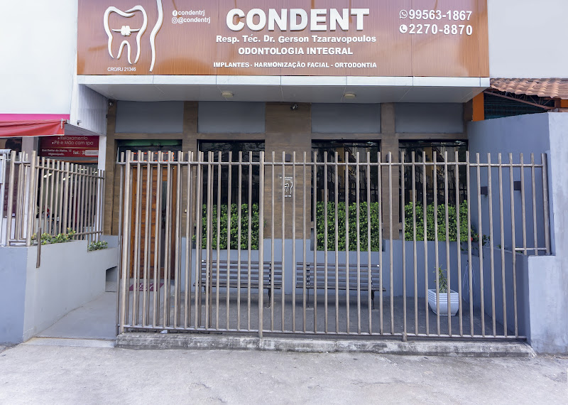 Foto 3 de Dentista Dr Gerson Clínica Condent | Implante Dentário, Lentes de contato dental, Harmonização Orofacial