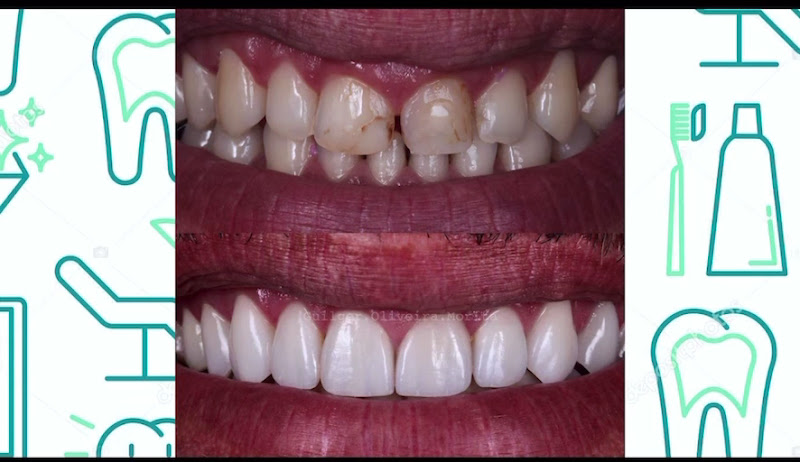 Foto 3 de Dentista Dr.Giordano Finholdt Consultório Odonto