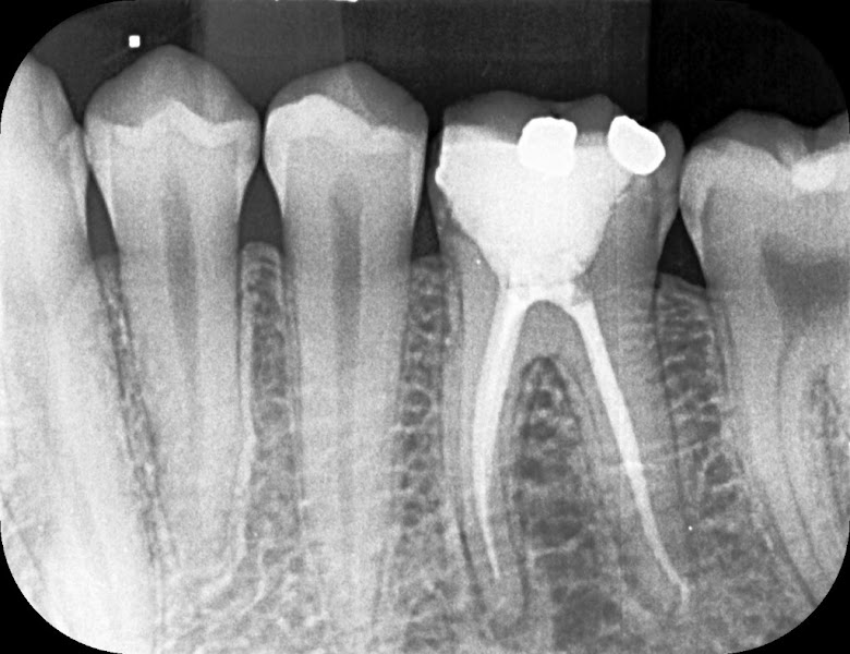Foto 2 de Dentista Dr. Gleison Duarte