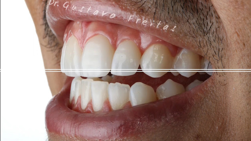 Foto 3 de Dentista Dr. Guga Freitas