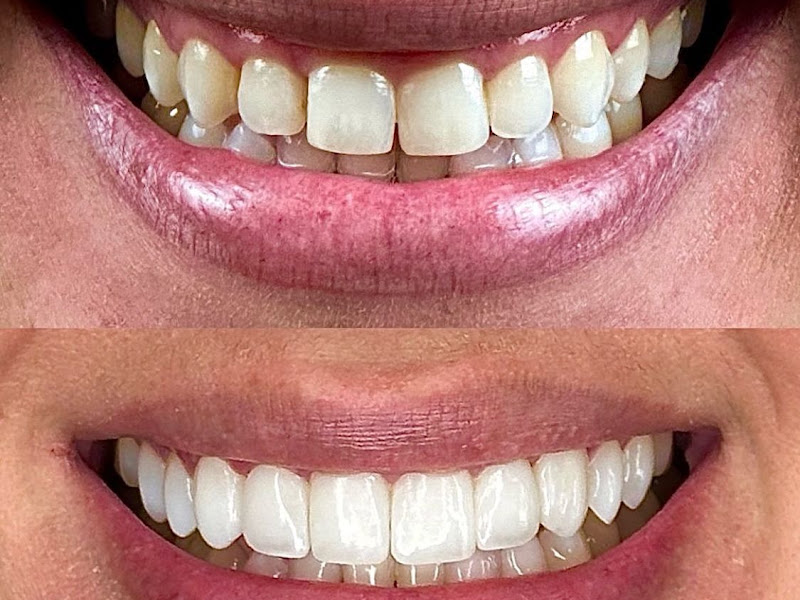 Foto de Dentista Dr Hiago Oliveira - Lentes e Implantes