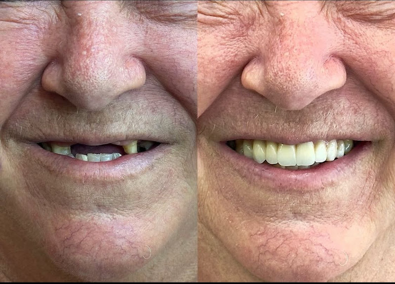 Foto 3 de Dentista Dr Hiago Oliveira - Lentes e Implantes