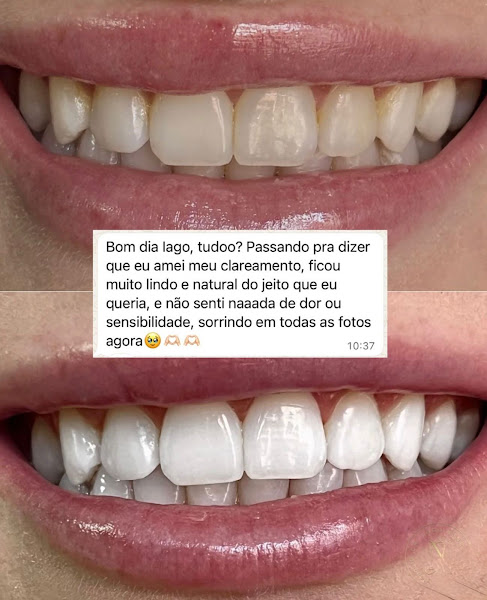 Foto 3 de Dentista Dr. Iago Nunes