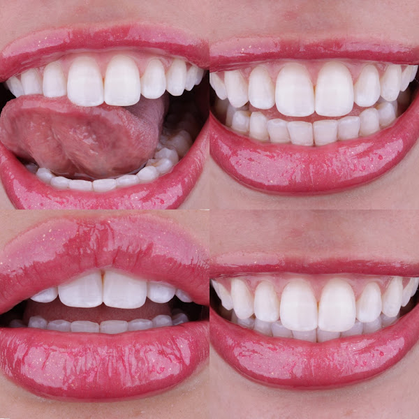 Foto 2 de Dentista Dr. Israel Jesus - Ipatinga Mg