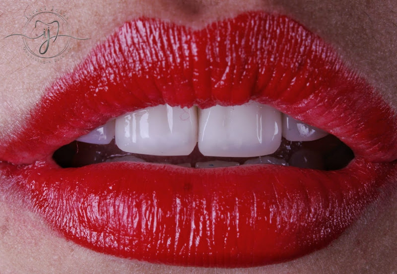 Foto 3 de Dentista Dr. Israel Jesus - Ipatinga Mg