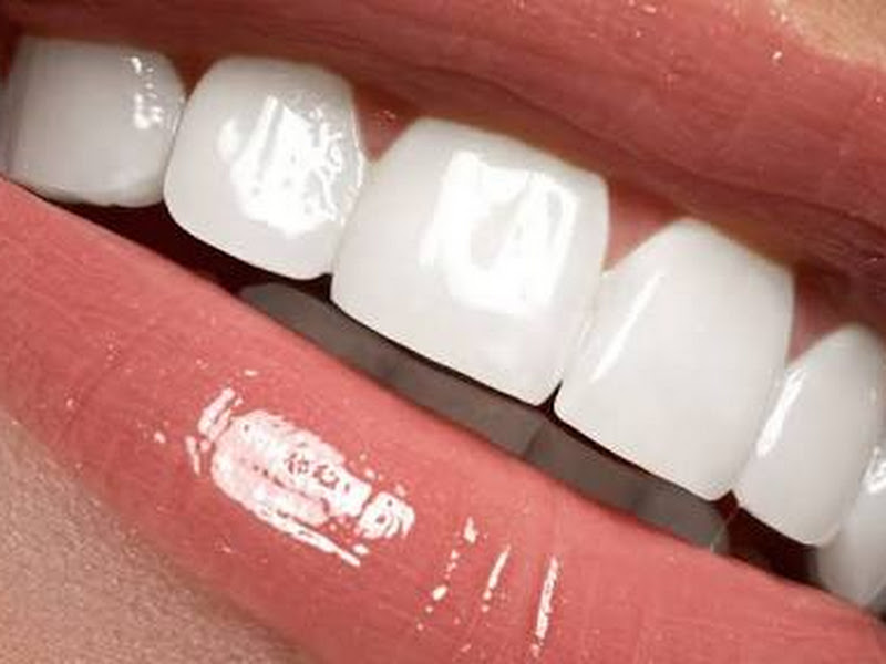 Foto 6 de Dentista Dr. Jacques Aguilar