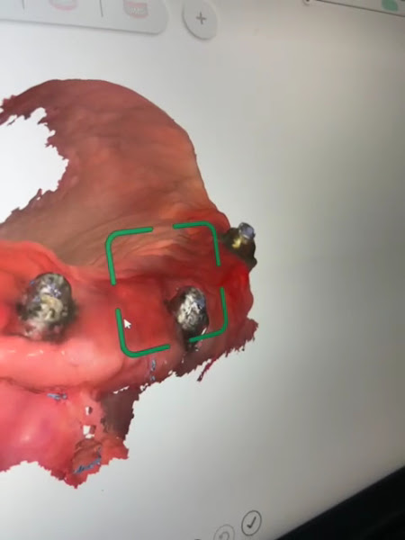 Foto 3 de Dentista Dr. Jadyson Abreu