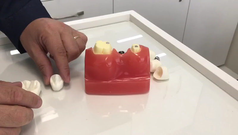 Foto 3 de Dentista Dr. James Burd - Implantes - Próteses - Ronco e Apnéia - Ortodontia