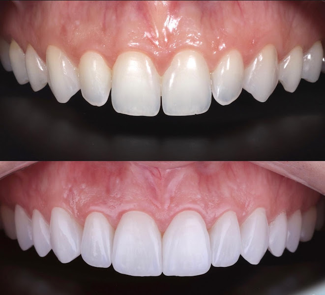 Foto 3 de Dentista Dr. Lucas Brasil