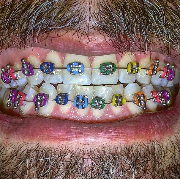 Foto 3 de Dentista - Dr. Lucas Fernandes Facetas Alinhador