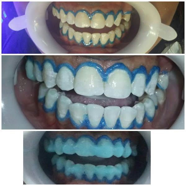 Foto 2 de Dentista Dr Luciano Reis Ribeiro