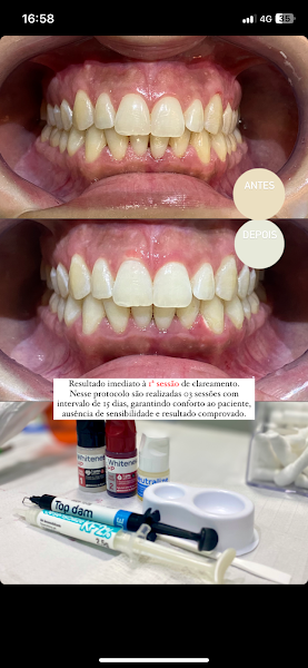 Foto 3 de Dentista - Dr. Marcelo Soares