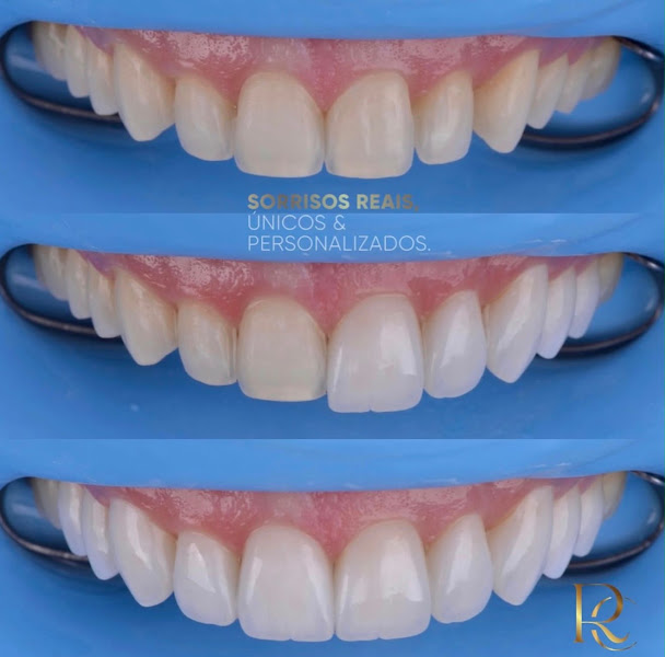 Foto 3 de Dentista - Dr. Rafael Cole / Cole Odontologia