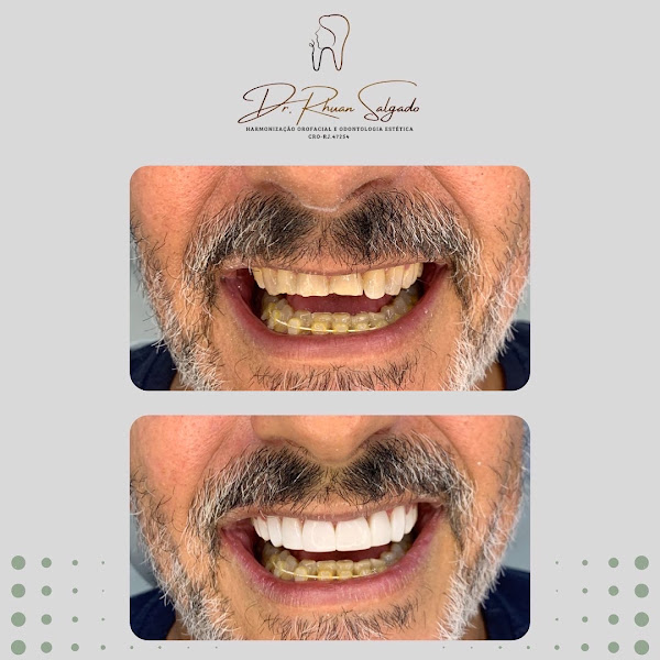 Foto 2 de Dentista Dr. Rhuan Salgado