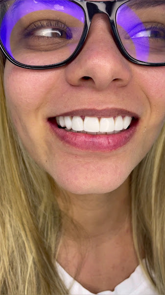 Foto 3 de Dentista Dr. Rhuan Salgado