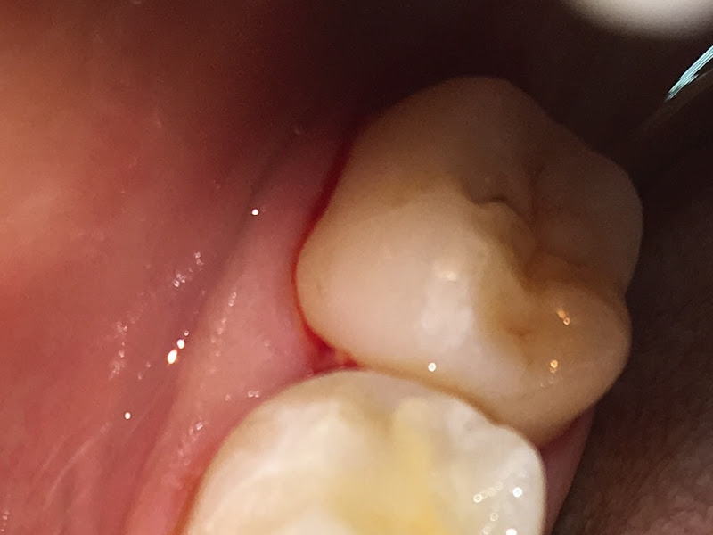 Foto 3 de Dentista Dr. Roberto Pereira Neves (Dr. R)