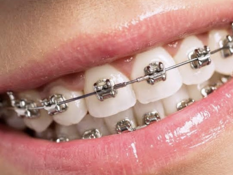 Foto 2 de Dentista Drº Wagner Leão