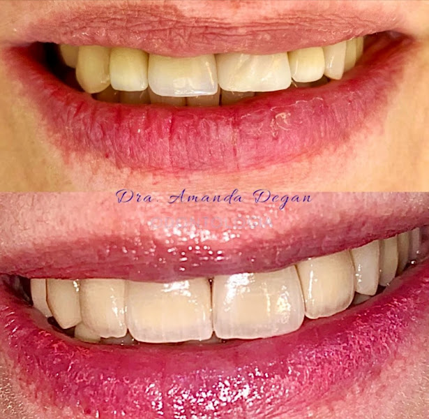 Foto 3 de Dentista Dra. Amanda Degan | Odontologia | Brooklin