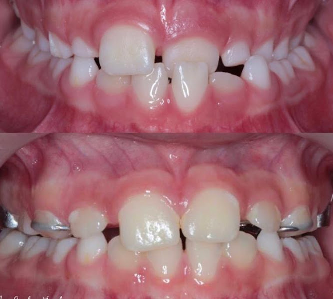 Foto 3 de Dentista Dra. Ana Carolina Miguel