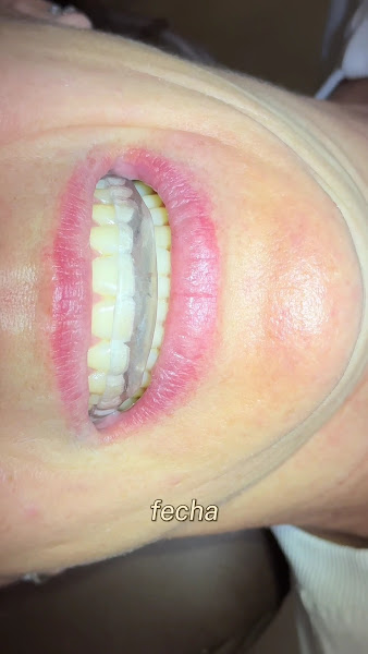 Foto 4 de Dentista Dra. Ana Letícia Magalhães