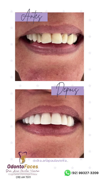 Foto 2 de Dentista - Dra. Ana Paula Vieira