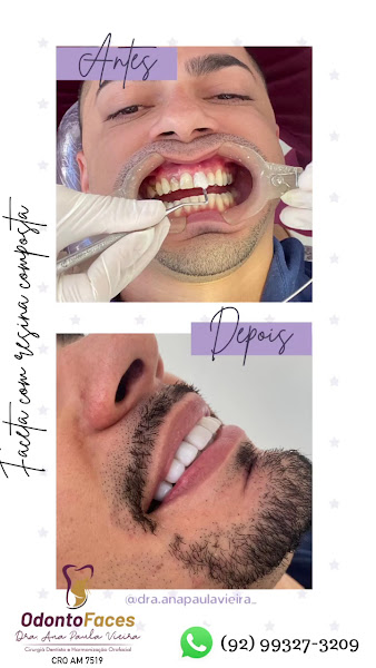 Foto 3 de Dentista - Dra. Ana Paula Vieira