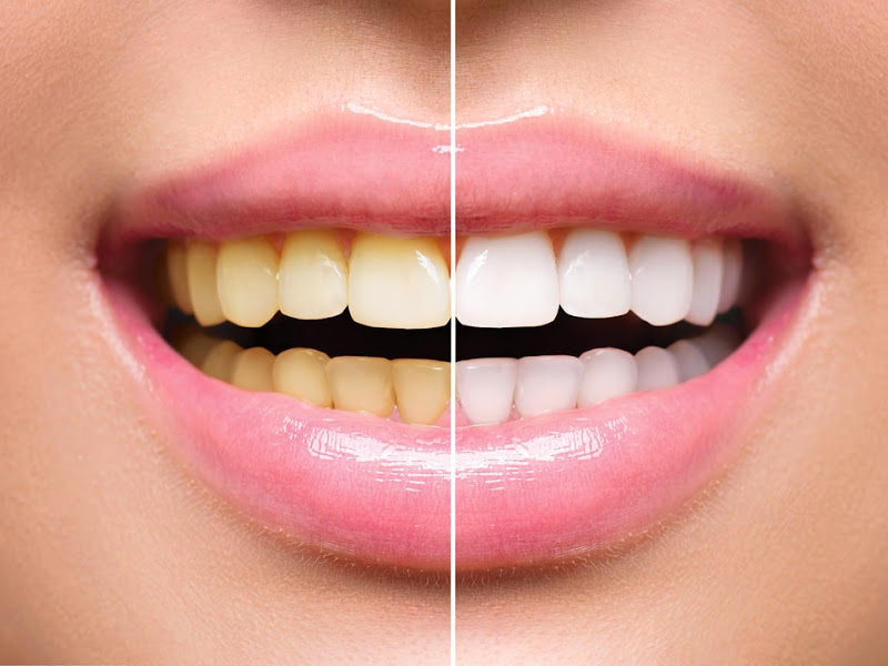 Foto 3 de Dentista Dra. Bruna Campos