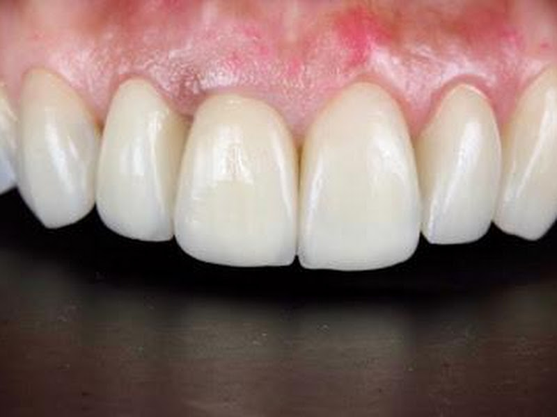 Foto 5 de Dentista Dra. Bruna Fernandes | Especialista em Ultraformer MPT | Harmonização Orofacial | Clínica Geral | Periodontia|