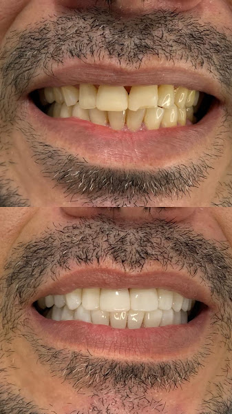 Foto 3 de Dentista Dra. Carla Moya | Odontologia | Guarulhos