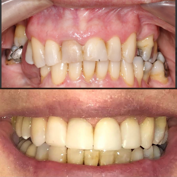 Foto 3 de Dentista - Dra Carla Tolfo - Em Chapecó SC