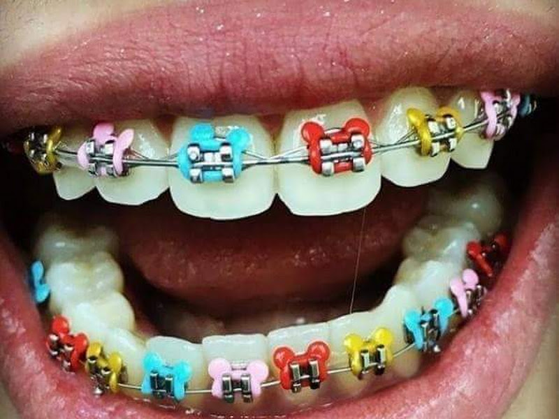 Foto 7 de Dentista Dra.Claudia Fiorillo