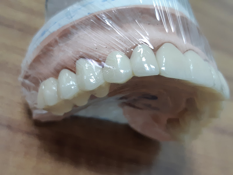 Foto 5 de Dentista - Dra Dulce A Silveira Lima