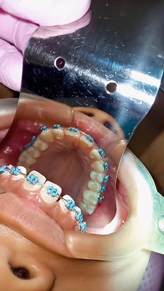 Foto 3 de Dentista Dra. Elenir Rocha