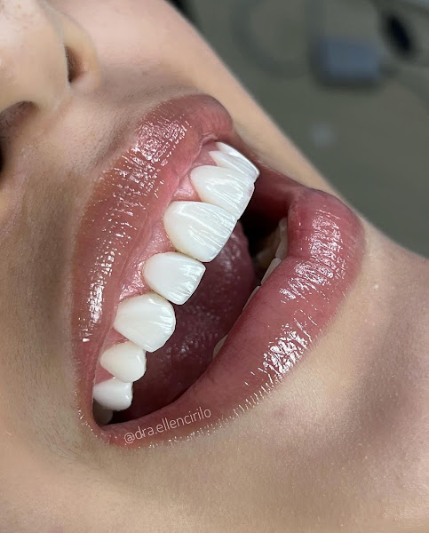 Foto 2 de Dentista Dra. Ellen Cirilo - atendimento particular