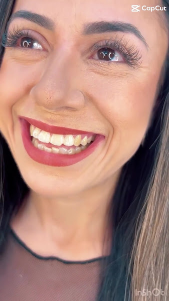 Foto 3 de Dentista Dra. Ellen Cirilo - atendimento particular