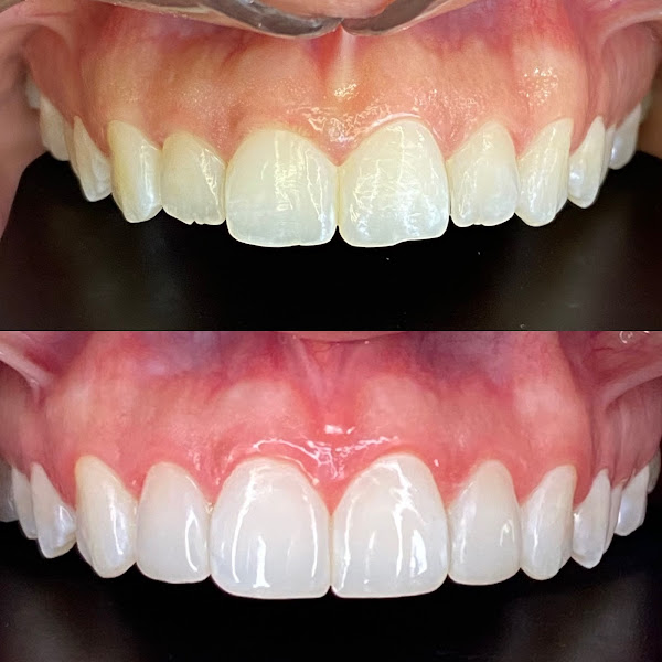 Foto 3 de Dentista Dra. Gabriella Oliveira - Ipanema