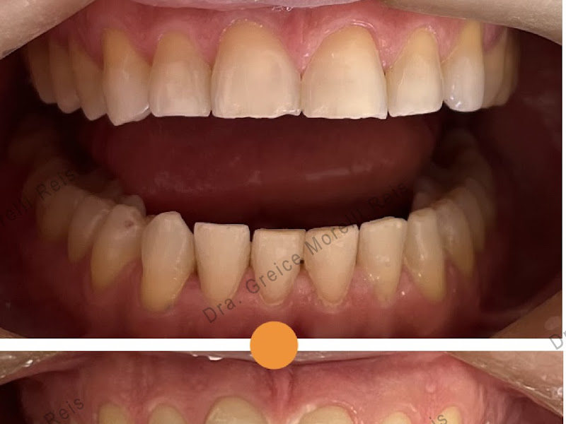 Foto 3 de Dentista Dra. Greice de Abreu Silveira