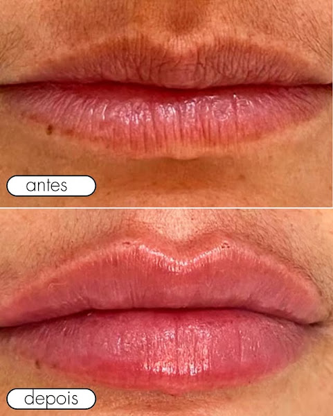 Foto 3 de Dentista Dra Ivandra Toresan