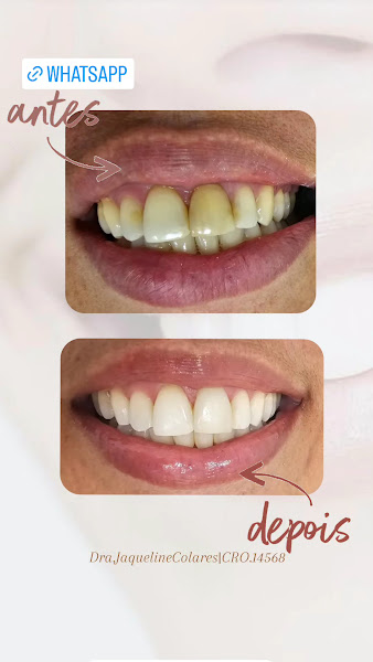 Foto 3 de Dentista Dra.Jaqueline Colares-Jardim Guararapes/COHAB SÃO FRANCISCO