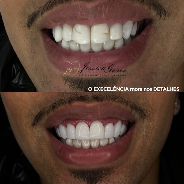 Foto 2 de Dentista Dra Jéssica Gama de Oliveira