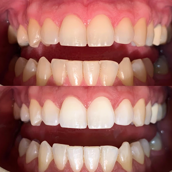 Foto 2 de Dentista Dra Karolaine Lima