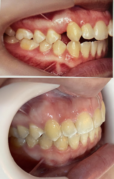 Foto 2 de Dentista Dra. Katerine | Guarulhos