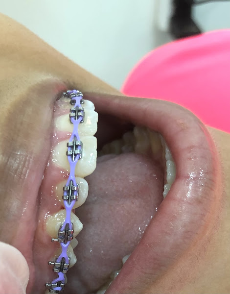 Foto 3 de Dentista Dra. Katerine | Guarulhos